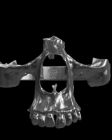 Broken Skull Ring | 925 Sterling Silver | Gothic Collection