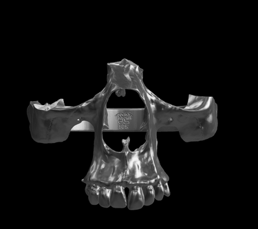 Broken Skull Ring | 925 Sterling Silver | Gothic Collection